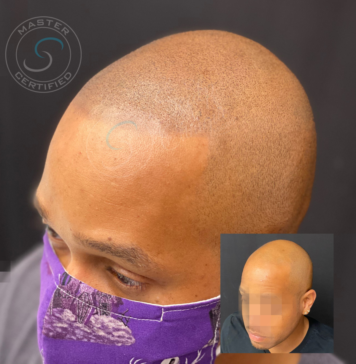 We Grow Hair Indy Scalp Directory